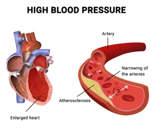 Understanding Blood Pressure and How It Works